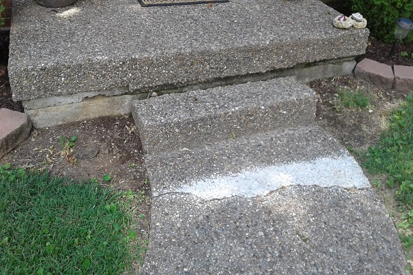 El remedio para el “Síndrome del Escalón Hundido”